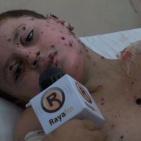 بعد رحلة علاج في ألمانيا.. الناجي الوحيد من المجزرة يعود