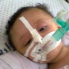 بالصور: جنان ومنة الله طفلتان.. من بقايا الموت بانتظار الحياة