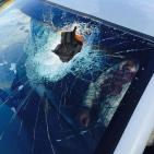 بالصور: اصابة مواطن اثر اعتداء مستوطنين عليه قرب نابلس