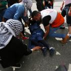 إصابات خلال المواجهات قرب مستوطنة 