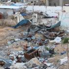 عزبة بيت حانون المهمشة.. الحرب لم تتوقف