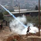 بالصور: 44 إصابة خلال مواجهات مع الاحتلال في بيتا وبيت دجن