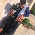 شاهد: عشرات الإصابات جراء قمع الاحتلال مسيرات بالضفة