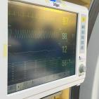 الصحة: تشغيل أول قسم لقسطرة قلب الأطفال في القطاع الحكومي