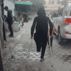 يوسف.. طفل غزي فقد والديه وشقيقيه وقدمه يحلُم بـ