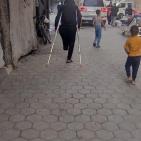 يوسف.. طفل غزي فقد والديه وشقيقيه وقدمه يحلُم بـ