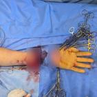 شاهد | إنجاز طبي.. مستشفى