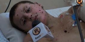 بعد رحلة علاج في ألمانيا.. الناجي الوحيد من المجزرة يعود