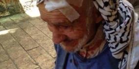 ما دام بي نفس ساقاوم -- المسن جريح في الاقصى