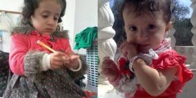 بالصور: جنان ومنة الله طفلتان.. من بقايا الموت بانتظار الحياة