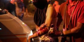 اصابات بالرصاص والاختناق في مواجهات مع الاحتلال غرب طولكرم