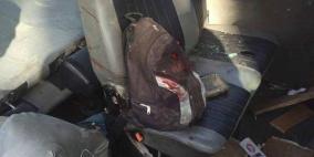 "محدث": اصابات في حادث سير قرب طولكرم