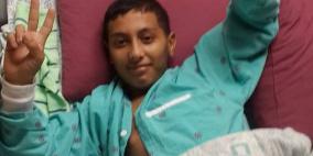 بتر اضافي لساق الطفل الجريح عيسى المعطي