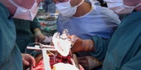 اقتراح قانون يزيد احتمالات استفادة الاحتلال من أعضاء فلسطينيي الداخل