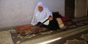 "بعد معاناة 57 عاما" مسنة غزية تناشد للحصول على طرف صناعي