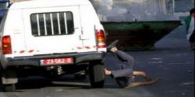 إصابة طفل تعرض للدهس من قبل مستوطِنة في القدس