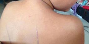 معلمة تستخدم "انبوب بلاستيكي" في عقاب طفل بمدرسة غرب رام الله