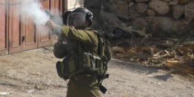 إصابة طفل بالرصاص الحي واعتقال 4 آخرين بمواجهات في يعبد