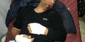 بيت لحم: وقفة احتجاجية للصحفيين ضد اعتداء الاحتلال على المصوّر شكارنة