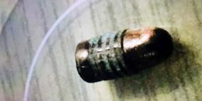 رصاص اسرائيلي جديد فتك بالشهيدين جوابرة وداوود