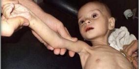 انتظرها أطفال جياع.. من أفشل وصول قافلة اليرموك للمخيم؟