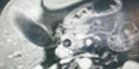 عملية نوعية لحالة نادرة على مستوى العالم في "المقاصد"