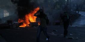 بيت لحم : اصابة فتى برصاصة معدنية في الرأس