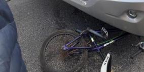  إصابة فتى بجراح خطيرة بحادث دهس في الناصرة