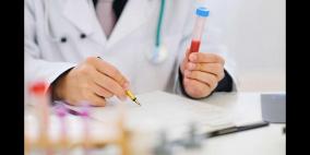 الكشف عن "السرطان" باختبار البول !!