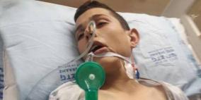 نتائج الفحوصات.. الاسير الطفل التميمي يفقد بصره كليا 