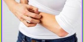 حكة الجلد بعد السباحة.. على ماذا تدل؟