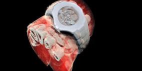 أول صورة ملونة بالأشعة السينية تجرى على إنسان