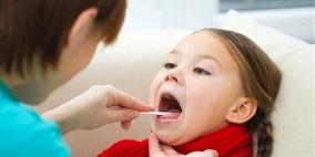 تجنبوا الحليب عند إستئصال اللوزتين