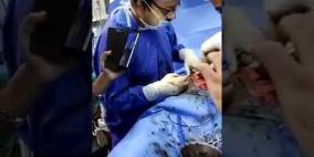 إبتلع 122 مسمارا ولم تجرح معدته