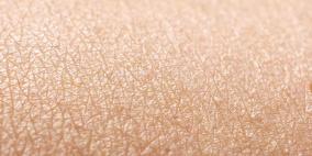 علماء يحذرون من بكتيريا قاتلة تعيش على جلد البشر