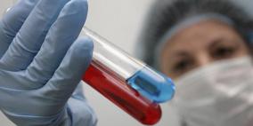  في 10 دقائق.. اختبار يكشف الإصابة بالسرطان