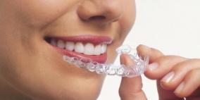 ابتكار "عدسات لاصقة" لتجميل الأسنان