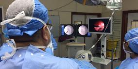 أغرب ولادة.. توأم متطابق "واحد بداخل الآخر"