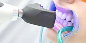 روبوتات مجهرية مخصصة لتنظيف الأسنان 