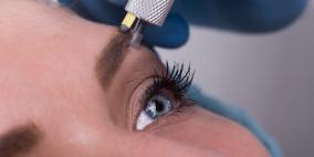 خضعت لعملية تجميل لحاجبيها.. فخرجت بأربعة حواجب!