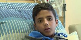 الرئيس يوعز بمتابعة علاج الطفل المصاب عبد الرحمن نوفل