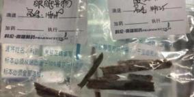 يكتشف وجود شظايا من الخشب في دماغه منذ 5 سنوات