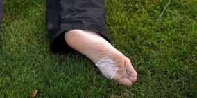 بكتيريا خطيرة تُفقد أمريكياً ساقه