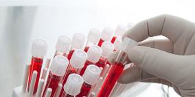 اختبار دم جديد يرصد 20 نوعا من السرطان