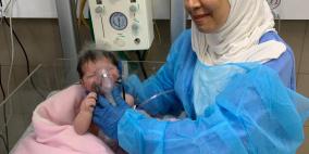 استئصال ورم سرطاني من قلب رضيعة بحجم 3 سم