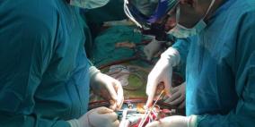 اغرب وفاة.. احتراق سيدة أثناء عملية جراحية