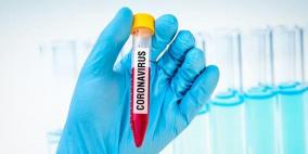 كورونا.. ابتكار مختبر تحاليل محمول في روسيا يكشف الفيروس