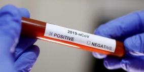 كيف يجري الفحص السريع لتشخيص الإصابة بكورونا؟
