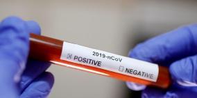 اطرح أي سؤال  بشأن كورونا على الصحة العالمية عبر واتساب