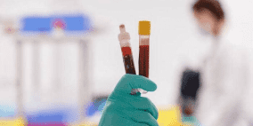 "الصحة العالمية": الأجسام المضادة لا تعني "الحصانة"